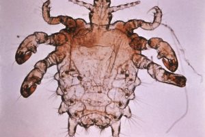 Get rid of crabs
